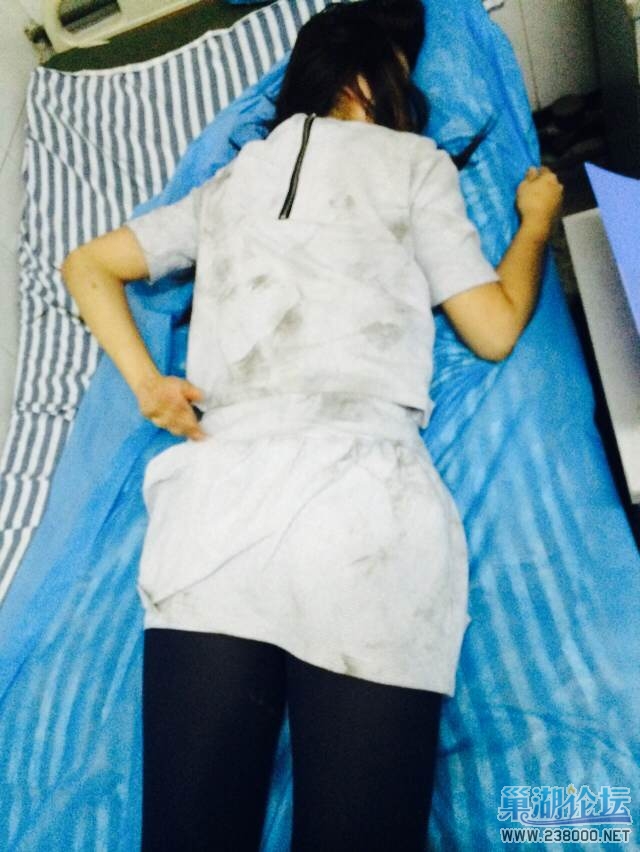 被踹的后背脚印