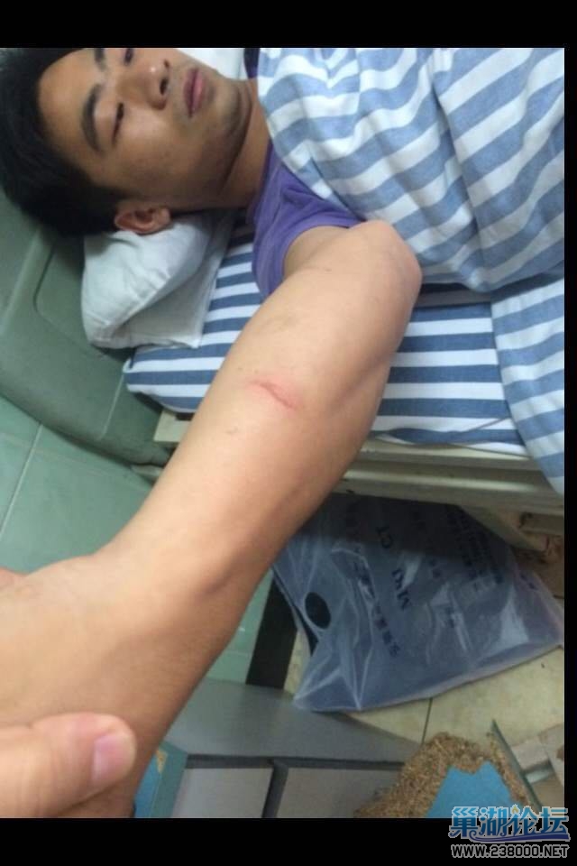 男子被抓伤